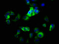 Immunofluorescence staining of MCF-7 cells with CSB-PA011864LA01HU at 1:200, counter-stained with DAPI. The cells were fixed in 4% formaldehyde, permeabilized using 0.2% Triton X-100 and blocked in 10% normal Goat Serum. The cells were then incubated with the antibody overnight at 4&deg;C. The secondary antibody was Alexa Fluor 488-congugated AffiniPure Goat Anti-Rabbit IgG(H+L).