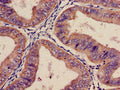 ITGA2 Antibody, FITC conjugated – Figure 1 of 2