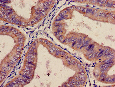 ITGA2 Antibody, FITC conjugated – Figure 1 of 2