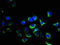 Immunofluorescence staining of A549 cells with CSB-PA011865LA01HU at 1:400, counter-stained with DAPI. The cells were fixed in 4% formaldehyde, permeabilized using 0.2% Triton X-100 and blocked in 10% normal Goat Serum. The cells were then incubated with the antibody overnight at 4&deg;C. The secondary antibody was Alexa Fluor 488-congugated AffiniPure Goat Anti-Rabbit IgG(H+L).
