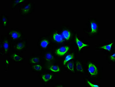 Immunofluorescence staining of A549 cells with CSB-PA011865LA01HU at 1:400, counter-stained with DAPI. The cells were fixed in 4% formaldehyde, permeabilized using 0.2% Triton X-100 and blocked in 10% normal Goat Serum. The cells were then incubated with the antibody overnight at 4&deg;C. The secondary antibody was Alexa Fluor 488-congugated AffiniPure Goat Anti-Rabbit IgG(H+L).