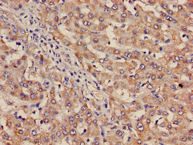 ITGA2B Antibody, HRP conjugated – Figure 1 of 2