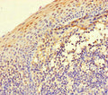 Immunohistochemistry of paraffin-embedded human tonsil tissue using CSB-PA011867LA01HU at dilution of 1:100