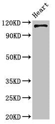 Western Blot
Positive WB detected in: Mouse heart tissue
All lanes: ITGA5 antibody at 4ug/ml
Secondary
Goat polyclonal to rabbit IgG at 1/50000 dilution
Predicted band size: 115 kDa
Observed band size: 115 kDa