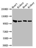Western Blot
Positive WB detected in: Rat heart tissue, Rat kidney tissue, Mouse heart tisseu, Mouse kidney tissue
All lanes: ITGA6 antibody at 3ug/ml
Secondary
Goat polyclonal to rabbit IgG at 1/50000 dilution
Predicted band size: 127, 120, 123, 122, 125, 107 kDa
Observed band size: 100 kDa