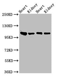 Western Blot
Positive WB detected in: Rat heart tissue, Rat kidney tissue, Mouse heart tisseu, Mouse kidney tissue
All lanes: ITGA6 antibody at 3ug/ml
Secondary
Goat polyclonal to rabbit IgG at 1/50000 dilution
Predicted band size: 127, 120, 123, 122, 125, 107 kDa
Observed band size: 100 kDa