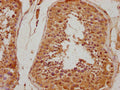 IHC image of CSB-PA011871NA01HU diluted at 1:500 and staining in paraffin-embedded human testis tissue performed on a Leica BondTM system. After dewaxing and hydration, antigen retrieval was mediated by high pressure in a citrate buffer (pH 6.0). Section was blocked with 10% normal goat serum 30min at RT. Then primary antibody (1% BSA) was incubated at 4°C overnight. The primary is detected by a biotinylated secondary antibody and visualized using an HRP conjugated SP system.