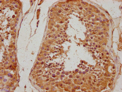 IHC image of CSB-PA011871NA01HU diluted at 1:500 and staining in paraffin-embedded human testis tissue performed on a Leica BondTM system. After dewaxing and hydration, antigen retrieval was mediated by high pressure in a citrate buffer (pH 6.0). Section was blocked with 10% normal goat serum 30min at RT. Then primary antibody (1% BSA) was incubated at 4°C overnight. The primary is detected by a biotinylated secondary antibody and visualized using an HRP conjugated SP system.