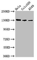 Western Blot
Positive WB detected in: Hela whole cell lysate, Colo320 whole cell lysate, A549 whole cell lysate
All lanes: ITGAV antibody at 2.7µg/ml
Secondary
Goat polyclonal to rabbit IgG at 1/50000 dilution
Predicted band size: 117, 113, 112 kDa
Observed band size: 130 kDa