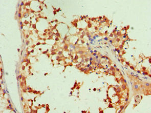 Immunohistochemistry of paraffin-embedded human testis tissue using CSB-PA011885ESR1HU at dilution of 1:100