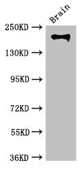 Western Blot
Positive WB detected in: Mouse brain tissue
All lanes: ITGB4 antibody at 3.5ug/ml
Secondary
Goat polyclonal to rabbit IgG at 1/50000 dilution
Predicted band size: 203, 196, 201, 195, 107 kDa
Observed band size: 203 kDa