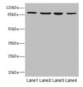 Western blot All lanes: ITGB7 antibody at 5.04ug/ml Lane 1: MCF-7 whole cell lysate Lane 2: HepG2 whole cell lysate Lane 3: A549 whole cell lysate Lane 4: K562 whole cell lysate Secondary Goat polyclonal to rabbit IgG at 1/10000 dilution Predicted band size: 87, 72 kDa Observed band size: 87 kDa