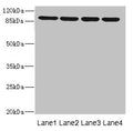 Western blot All lanes: ITGB8 antibody at 1.52µg/ml Lane 1: 293T whole cell lysate Lane 2: Hela whole cell lysate Lane 3: HepG2 whole cell lysate Lane 4: A549 whole cell lysate Secondary Goat polyclonal to rabbit IgG at 1/10000 dilution Predicted band size: 86, 72 kDa Observed band size: 86 kDa