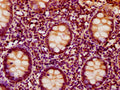 IHC image of CSB-PA011921LA01HU diluted at 1:500 and staining in paraffin-embedded human appendix tissue performed on a Leica BondTM system. After dewaxing and hydration, antigen retrieval was mediated by high pressure in a citrate buffer (pH 6.0). Section was blocked with 10% normal goat serum 30min at RT. Then primary antibody (1% BSA) was incubated at 4°C overnight. The primary is detected by a biotinylated secondary antibody and visualized using an HRP conjugated SP system.