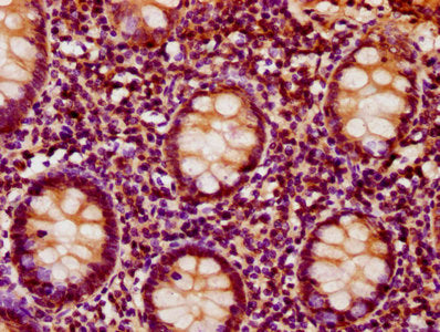 IHC image of CSB-PA011921LA01HU diluted at 1:500 and staining in paraffin-embedded human appendix tissue performed on a Leica BondTM system. After dewaxing and hydration, antigen retrieval was mediated by high pressure in a citrate buffer (pH 6.0). Section was blocked with 10% normal goat serum 30min at RT. Then primary antibody (1% BSA) was incubated at 4°C overnight. The primary is detected by a biotinylated secondary antibody and visualized using an HRP conjugated SP system.