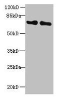 Western blot
All lanes: KEAP1 antibody at 2µg/ml
Lane 1: Mouse kidney tissue
Lane 2: NIH/3T3 whole cell lysate
Secondary
Goat polyclonal to rabbit IgG at 1/10000 dilution
Predicted band size: 70 kDa
Observed band size: 70 kDa