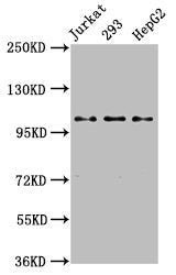 Western Blot
Positive WB detected in: Jurkat whole cell lysate, 293 whole cell lysate, HepG2 whole cell lysate
All lanes: KIF5B antibody at 3.2µg/ml
Secondary
Goat polyclonal to rabbit IgG at 1/50000 dilution
Predicted band size: 110 kDa
Observed band size: 110 kDa