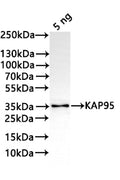 Western Blot
Positive WB detected in: recombinant protein
All lanes:KAP95 Antibody at 1:1000
Secondary
Goat polyclonal to rabbit IgG at 1/20000 dilution
Predicted band size: 34.6 kDa
Observed band size: 34 kDa