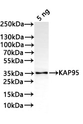 Western Blot
Positive WB detected in: recombinant protein
All lanes:KAP95 Antibody at 1:1000
Secondary
Goat polyclonal to rabbit IgG at 1/20000 dilution
Predicted band size: 34.6 kDa
Observed band size: 34 kDa