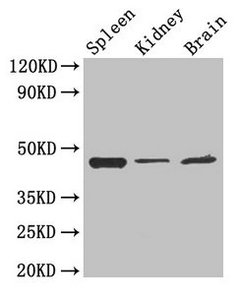 Western Blot
Positive WB detected in: Mouse spleen tissue, Mouse kidney tissue, Mouse brain tissue
All lanes: LAMP2 antibody at 4µg/ml
Secondary
Goat polyclonal to rabbit IgG at 1/50000 dilution
Predicted band size: 45, 46 kDa
Observed band size: 45 kDa
