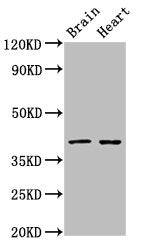 Western Blot
Positive WB detected in: Rat brain tissue, Rat heart tissue
All lanes: CERS1 antibody at 3ug/ml
Secondary
Goat polyclonal to rabbit IgG at 1/50000 dilution
Predicted band size: 40, 38 kDa
Observed band size: 40 kDa