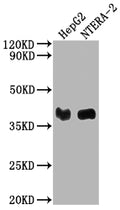 Western Blot
Positive WB detected in: HepG2 whole cell lysate, NTERA-2 whole cell lysate
All lanes: LCMT1 antibody at 1:2000
Secondary
Goat polyclonal to rabbit IgG at 1/50000 dilution
Predicted band size: 39, 42, 33 kDa
Observed band size: 39 kDa