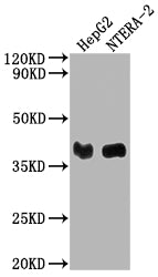 Western Blot
Positive WB detected in: HepG2 whole cell lysate, NTERA-2 whole cell lysate
All lanes: LCMT1 antibody at 1:2000
Secondary
Goat polyclonal to rabbit IgG at 1/50000 dilution
Predicted band size: 39, 42, 33 kDa
Observed band size: 39 kDa