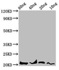 Western Blot
Positive WB detected in Recombinant protein
All lanes: LEP antibody at 4.7µg/ml
Secondary
Goat polyclonal to rabbit IgG at 1/50000 dilution
Predicted band size: 21 kDa
Observed band size: 21 kDa