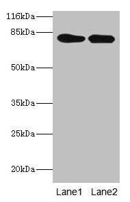 Western blot
All lanes: LHCGR antibody at 2µg/ml
Lane 1: Mouse brain tissue
Lane 2: Mouse kidney tissue
Secondary
Goat polyclonal to rabbit IgG at 1/10000 dilution
Predicted band size: 79, 72 kDa
Observed band size: 79 kDa