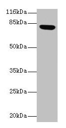Western blot
All lanes: Lhcgr antibody at 2µg/ml + Rat gonadal tissue
Secondary
Goat polyclonal to rabbit IgG at 1/10000 dilution
Predicted band size: 79, 35, 38, 73, 28, 33, 21, 72, 31, 34, 41 kDa
Observed band size: 79 kDa