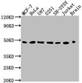 Western Blot
Positive WB detected in: MCF-7 whole cell lysate, HeLa whole cell lysate, U87 whole cell lysate, U251 whole cell lysate, SH-SY5Y whole cell lysate, Jurkat whole cell lysate, Rat brain tissue
All lanes: LOX antibody at 1:2000
Secondary
Goat polyclonal to rabbit IgG at 1/50000 dilution
Predicted band size: 47 kDa
Observed band size: 47 kDa
