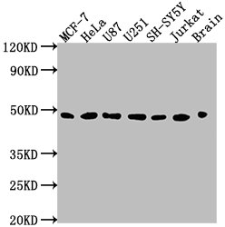 Western Blot
Positive WB detected in: MCF-7 whole cell lysate, HeLa whole cell lysate, U87 whole cell lysate, U251 whole cell lysate, SH-SY5Y whole cell lysate, Jurkat whole cell lysate, Rat brain tissue
All lanes: LOX antibody at 1:2000
Secondary
Goat polyclonal to rabbit IgG at 1/50000 dilution
Predicted band size: 47 kDa
Observed band size: 47 kDa