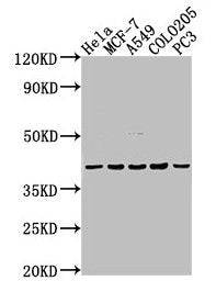 Western Blot
Positive WB detected in: Hela whole cell lysate, MCF-7 whole cell lysate, A549 whole cell lysate, COLO205 whole cell lysate, PC-3 whole cell lysate
All lanes: LPAR2 antibody at 1:2000
Secondary
Goat polyclonal to rabbit IgG at 1/50000 dilution
Predicted band size: 40 kDa
Observed band size: 40 kDa