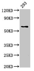 Western Blot
Positive WB detected in: 293 whole cell lysate
All lanes: LPCAT2 antibody at 5ug/ml
Secondary
Goat polyclonal to rabbit IgG at 1/50000 dilution
Predicted band size: 61, 31 kDa
Observed band size: 61 kDa