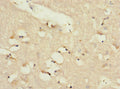 Immunohistochemistry of paraffin-embedded human brain tissue using CSB-PA013060ESR2HU at dilution of 1:100