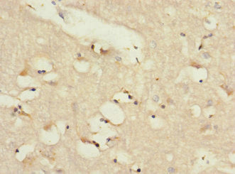 Immunohistochemistry of paraffin-embedded human brain tissue using CSB-PA013060ESR2HU at dilution of 1:100