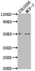 Western Blot
Positive WB detected in: COLO205 whole cell lysate, MCF-7 whole cell lysate
All lanes: LRAT antibody at 1:2000
Secondary
Goat polyclonal to rabbit IgG at 1/50000 dilution
Predicted band size: 26 kDa
Observed band size: 50 kDa