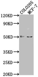Western Blot
Positive WB detected in: COLO205 whole cell lysate, MCF-7 whole cell lysate
All lanes: LRAT antibody at 1:2000
Secondary
Goat polyclonal to rabbit IgG at 1/50000 dilution
Predicted band size: 26 kDa
Observed band size: 50 kDa