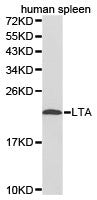Western blot analysis of extracts of human spleen cell lines, using LTA antibody.