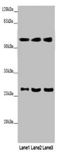 Western blot
All lanes: MAOB antibody at 9µg/ml
Lane 1: Mouse liver tissue
Lane 2: HepG2 whole cell lysate
Lane 3: A549 whole cell lysate
Secondary
Goat polyclonal to rabbit IgG at 1/10000 dilution
Predicted band size: 59, 47 kDa
Observed band size: 59, 27 kDa