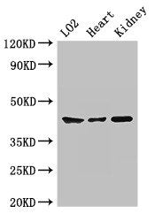 Western Blot
Positive WB detected in: LO2 whole cell lysate, Mouse heart tissue, Mouse kidney tissue
All lanes: MAP2K1 antibody at 2ug/ml
Secondary
Goat polyclonal to rabbit IgG at 1/50000 dilution
Predicted band size: 44, 41 kDa
Observed band size: 44 kDa