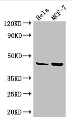 Western Blot
Positive WB detected in: Hela whole cell lysate, MCF-7 whole cell lysate
All lanes: MAP2K4 antibody at 3.25ug/ml
Secondary
Goat polyclonal to rabbit IgG at 1/50000 dilution
Predicted band size: 45, 46 kDa
Observed band size: 45 kDa