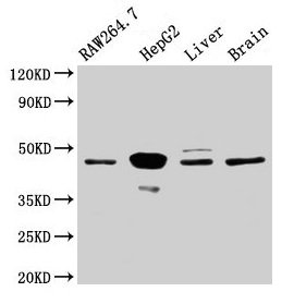 Western Blot
Positive WB detected in: RAW264.7 whole cell lysate, HepG2 whole cell lysate, Rat liver tissue, Mouse brain tissue
All lanes: Map2k4 antibody at 3.2µg/ml
Secondary
Goat polyclonal to rabbit IgG at 1/50000 dilution
Predicted band size: 45 kDa
Observed band size: 45 kDa