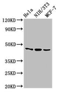 Western Blot
Positive WB detected in: Hela whole cell lysate, NIH/3T3 whole cell lysate, MCF-7 whole cell lysate
All lanes: MAP2K7 antibody at 2.7µg/ml
Secondary
Goat polyclonal to rabbit IgG at 1/50000 dilution
Predicted band size: 48, 52, 50, 49 kDa
Observed band size: 48 kDa