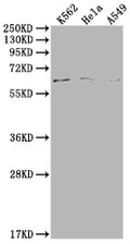 Western Blot
Positive WB detected in: K562 whole cell lysate, Hela whole cell lysate, A549 whole cell lysate
All lanes: MAP3K7 antibody at 1:500
Secondary
Goat polyclonal to rabbit IgG at 1/50000 dilution
Predicted band size: 68, 65, 57, 54 kDa
Observed band size: 68 kDa