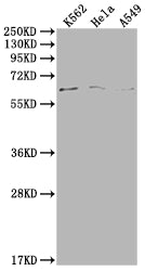 Western Blot
Positive WB detected in: K562 whole cell lysate, Hela whole cell lysate, A549 whole cell lysate
All lanes: MAP3K7 antibody at 1:500
Secondary
Goat polyclonal to rabbit IgG at 1/50000 dilution
Predicted band size: 68, 65, 57, 54 kDa
Observed band size: 68 kDa