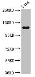 Western Blot
Positive WB detected in: Rat lung tissue
All lanes: MAP3K9 antibody at 2.7ug/ml
Secondary
Goat polyclonal to rabbit IgG at 1/50000 dilution
Predicted band size: 122, 124 kDa
Observed band size: 122 kDa