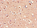 Immunohistochemistry of paraffin-embedded human brain tissue using CSB-PA013449LA01HU at dilution of 1:100