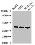 Western Blot
Positive WB detected in: HepG2 whole cell lysate, A549 whole cell lysate, Mouse skeletal muscle tissue
All lanes: MAPK12 antibody at 2.7µg/ml
Secondary
Goat polyclonal to rabbit IgG at 1/50000 dilution
Predicted band size: 42, 41 kDa
Observed band size: 42 kDa