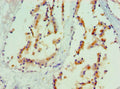 Immunohistochemistry of paraffin-embedded human prostate tissue using CSB-PA013452ESR1HU at dilution of 1:100